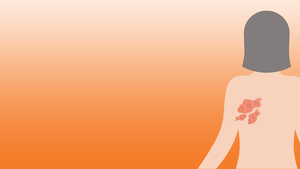 Le zona : reconnaître les signes et agir rapidement