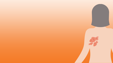 Le zona : reconnaître les signes et agir rapidement